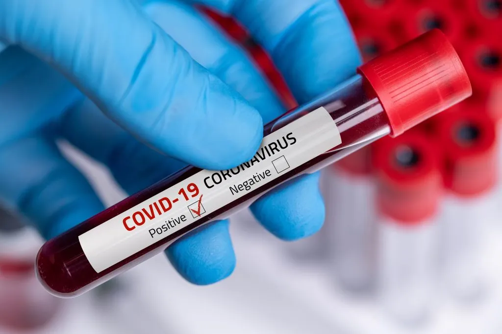 coronavirus-test