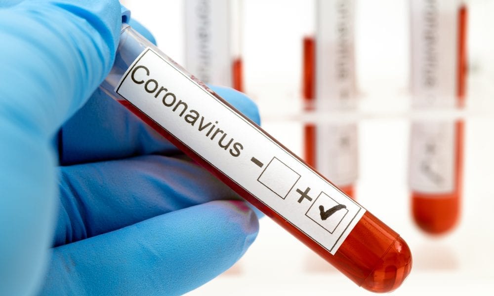 coronavirus-testing covid 19