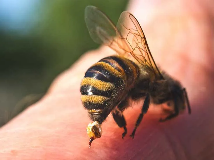 732x549_How_Is_An_Infected_Bee_Sting_Treated-1-732x549